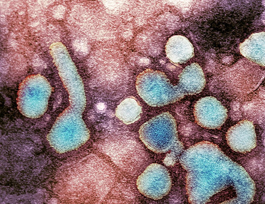 H5n1 Avian Influenza Virus Particles, Tem is a photograph by Nibsc which was uploaded on May 11th, 2013.